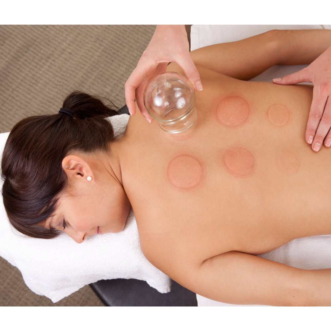 Cupping treatment